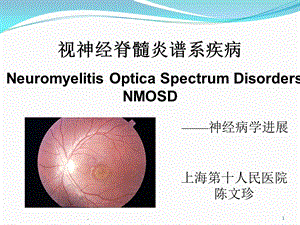 视神经脊髓炎谱系疾病课件.ppt