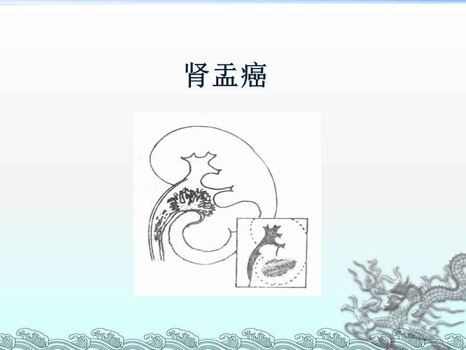 肾盂癌课件.ppt_第1页