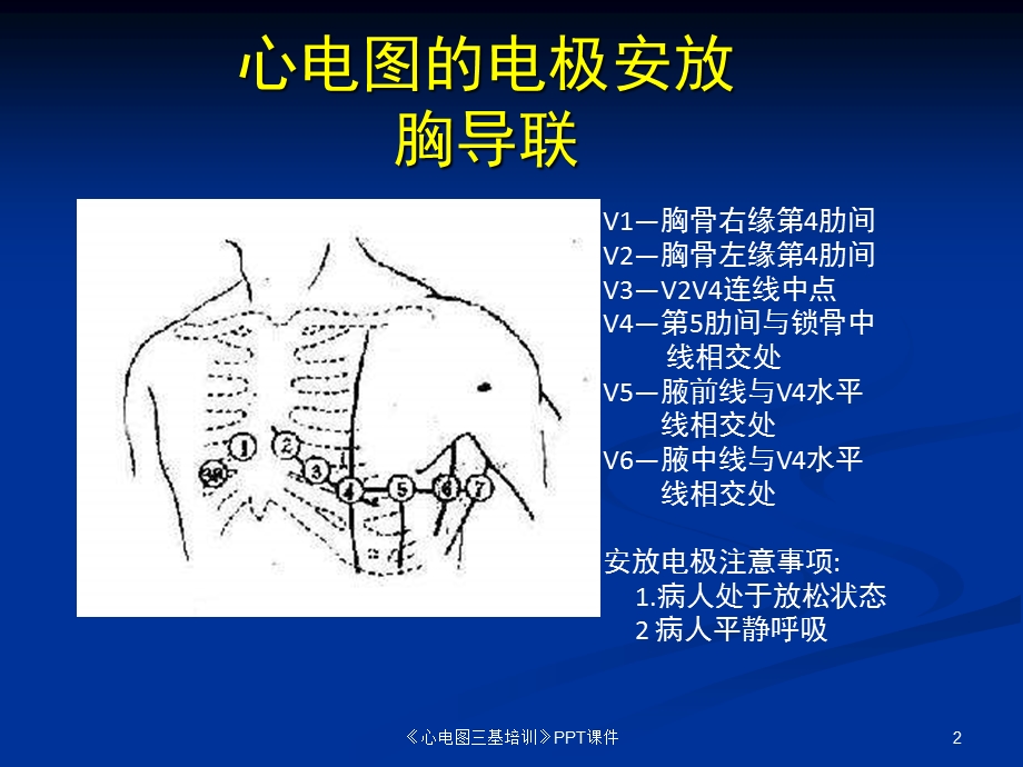 《心电图三基培训》课件.ppt_第2页