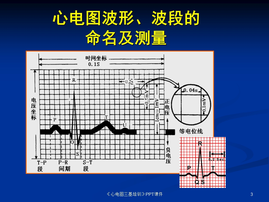 《心电图三基培训》课件.ppt_第3页