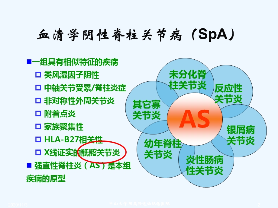 SpA骶髂关节炎影像学诊断和鉴别诊断课件.ppt_第2页