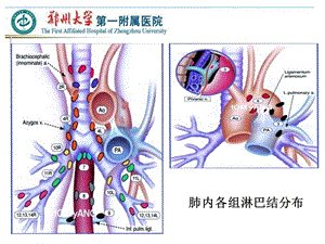 VATS左侧肺癌根治术中的淋巴结清扫主题讲座课件.ppt