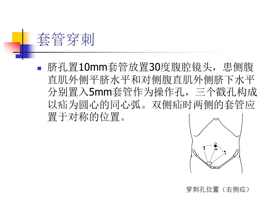 TAPP手术技巧课件.pptx_第2页