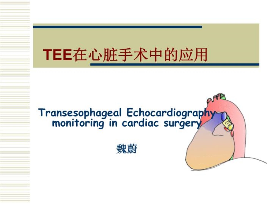 TEE在心脏手术中的应用1-课件.ppt_第2页