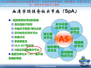 SpA骶髂关节炎的影像学诊疗和鉴别诊疗培训课件.ppt