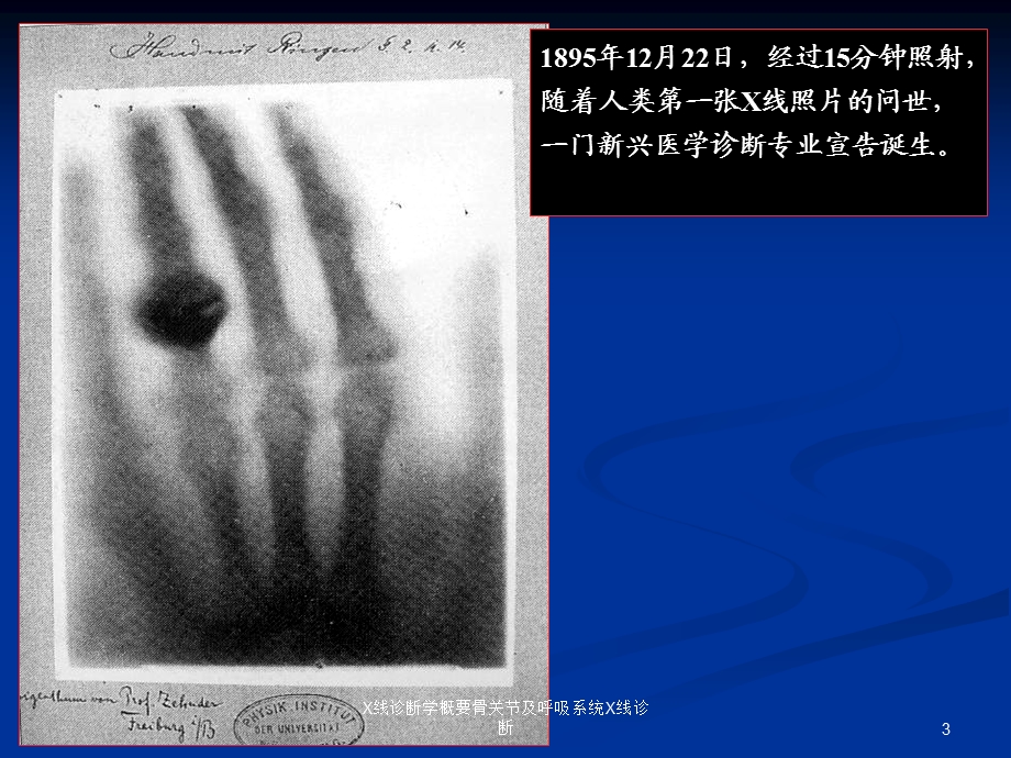 X线诊断学概要骨关节及呼吸系统X线诊断课件.ppt_第3页