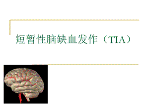 TIA-短暂性脑缺血发作课件.ppt