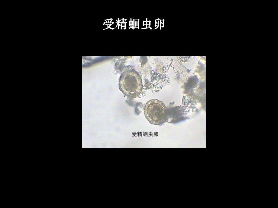 人体寄生虫标本考试培训课件.ppt_第2页