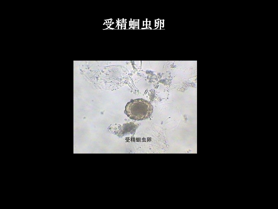 人体寄生虫标本考试培训课件.ppt_第3页