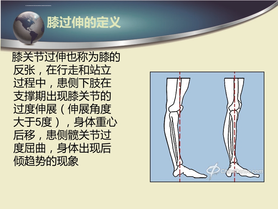 膝过伸的原因和训练方法ppt课件.ppt_第1页