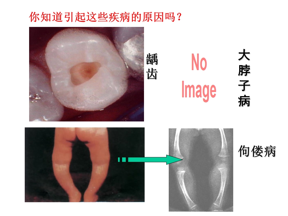 九年级人教版化学下册第十二单元课题2化学元素与人体健康课件(共22张).pptx_第2页