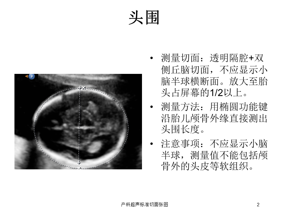 产科超声标准切面张图培训课件.ppt_第2页