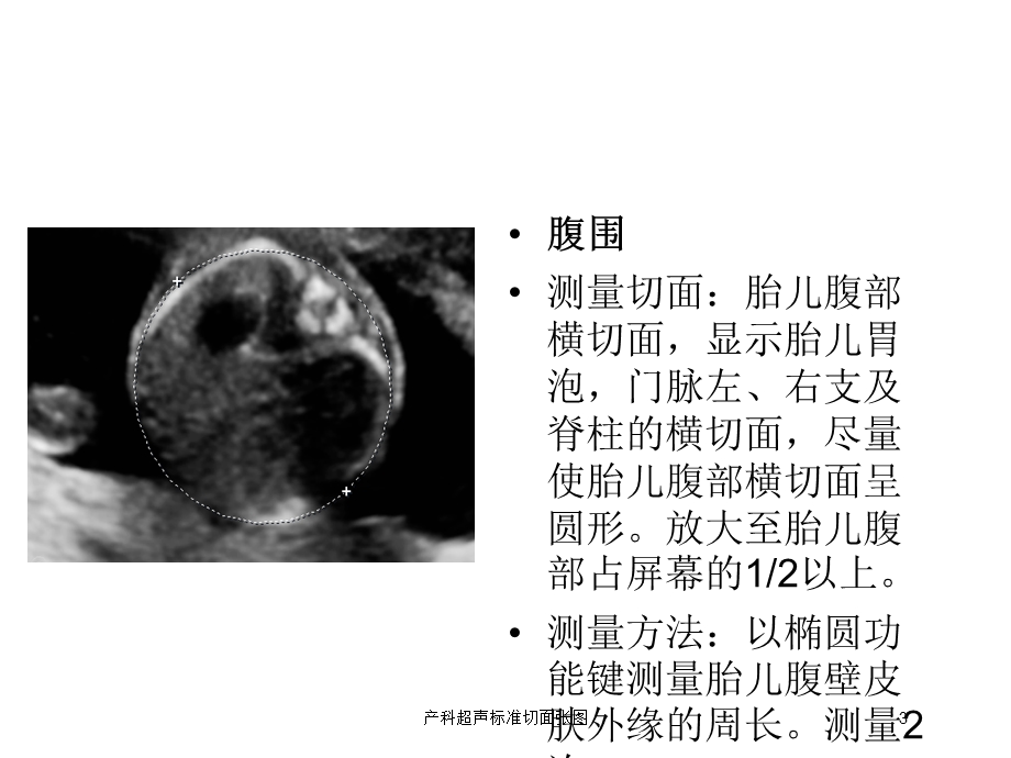 产科超声标准切面张图培训课件.ppt_第3页