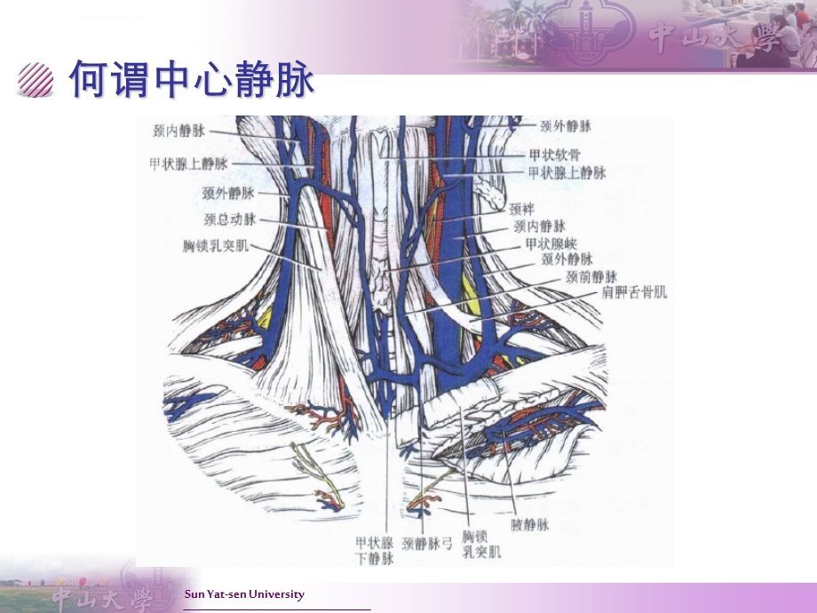 CVC置管与护理ppt课件.ppt_第2页