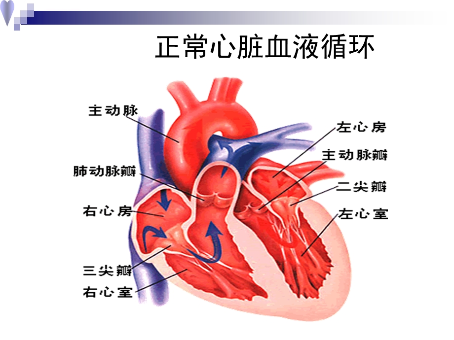 心脏瓣膜病ppt课件.ppt_第3页