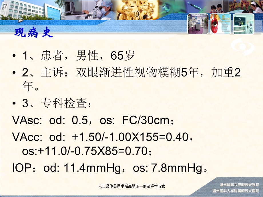 人工晶体悬吊术后高眼压一例及手术方式培训课件.ppt_第2页