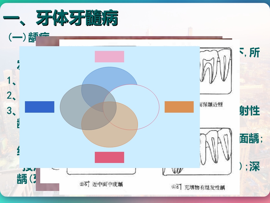 五官科学口腔科常见疾病课件.pptx_第2页