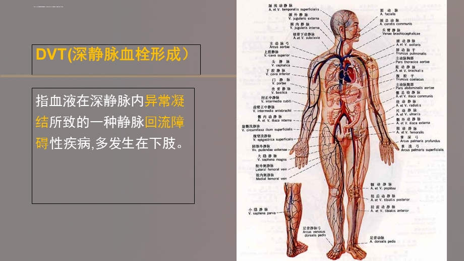 dvt的预防及护理ppt课件.ppt_第2页