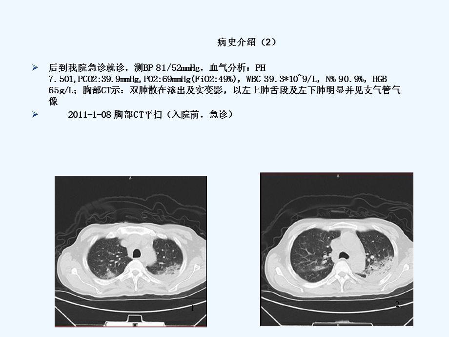 人民肺念珠菌病课件.ppt_第3页