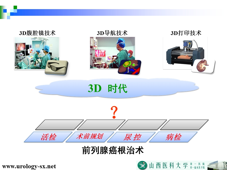 3D时代对前列腺癌根治术一些问题的再认识ppt课件.pptx_第2页