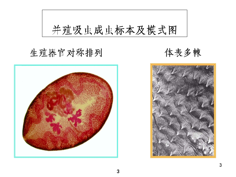 人体寄生虫学教学课件——卫氏并殖吸虫.ppt_第3页