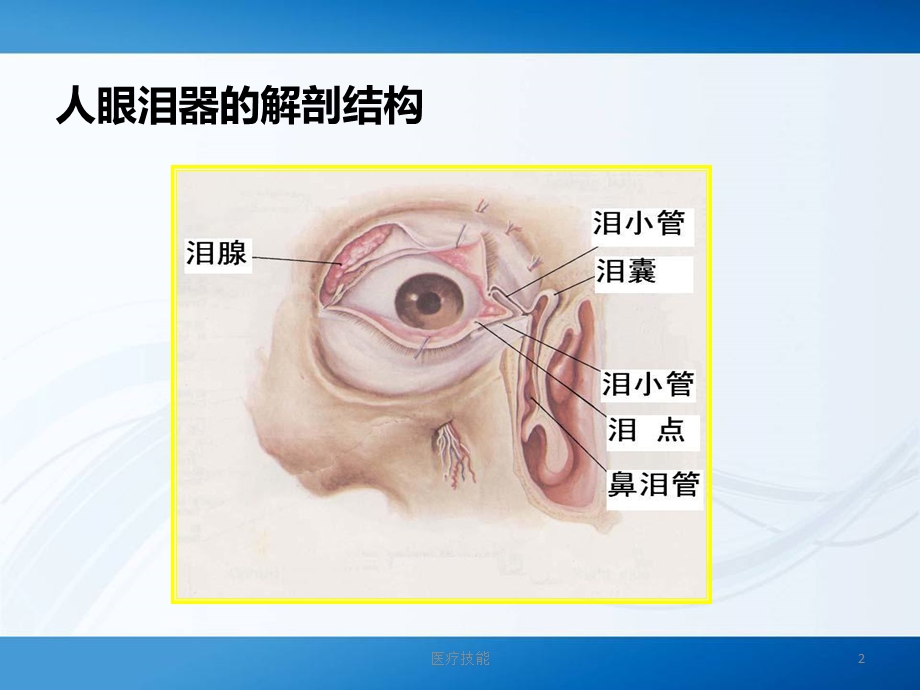 人工鼻泪管支架植入术(医疗研究)课件.ppt_第2页