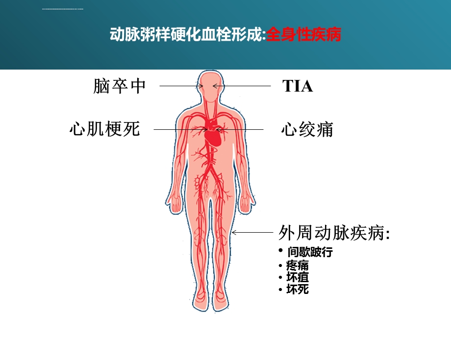 ASCVD时代总体心血管风险评估工具的更新ppt课件.ppt_第3页