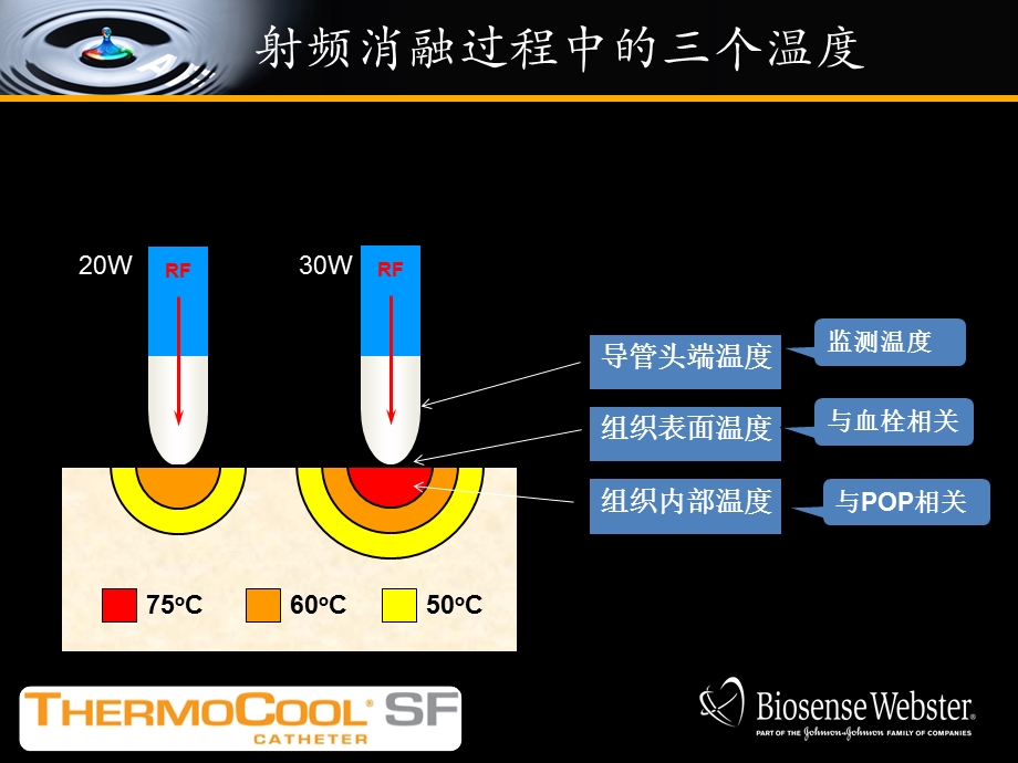 射频消融原理ppt课件.pptx_第3页