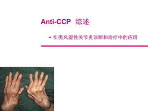 CCP抗环状胍氨酸肽抗体ppt课件.ppt