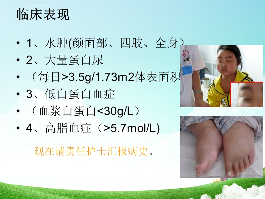 肾病综合征护理查房ppt课件.ppt_第3页