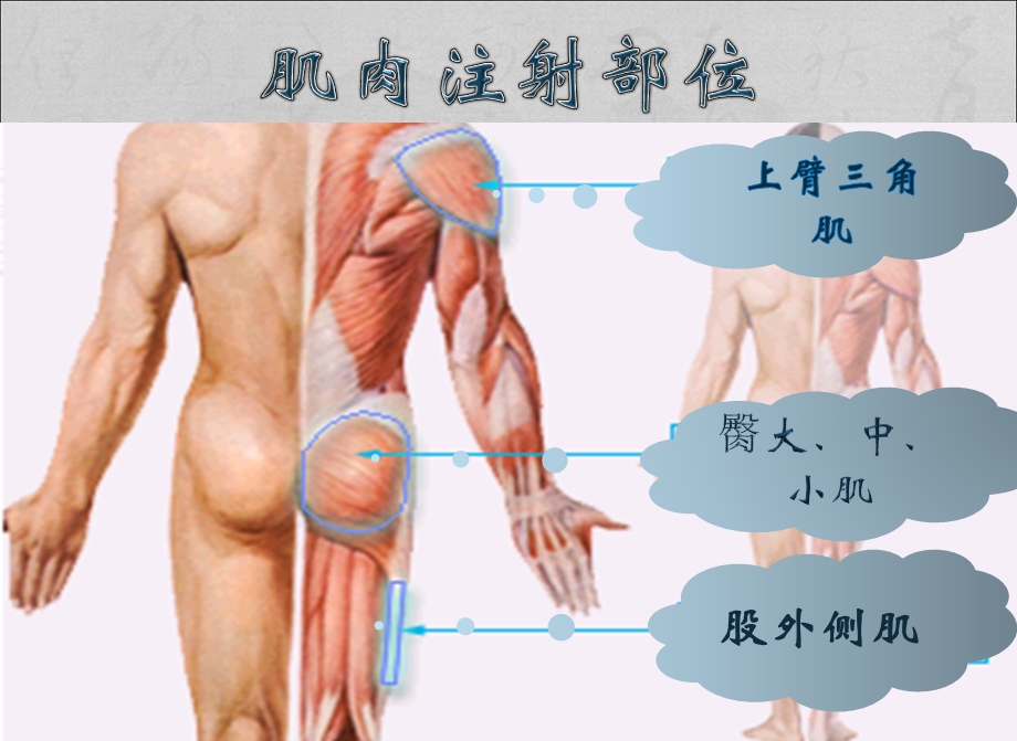 产科肌内注射培训及注意事项课件.ppt_第3页