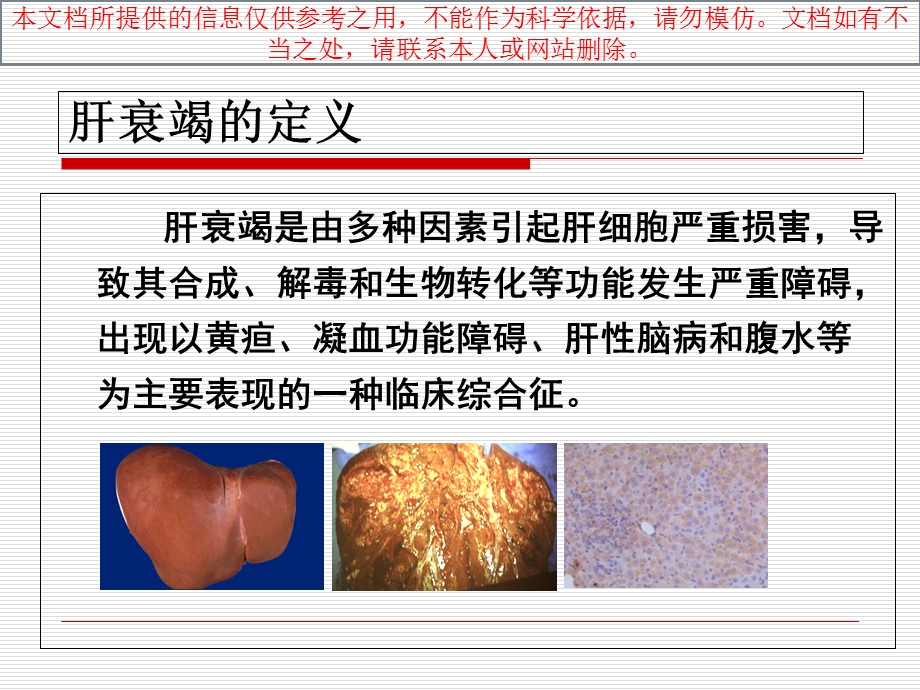 人工肝医学课件培训课件.ppt_第1页