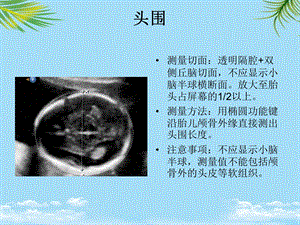 产科超声标准切面张图全面版课件.ppt