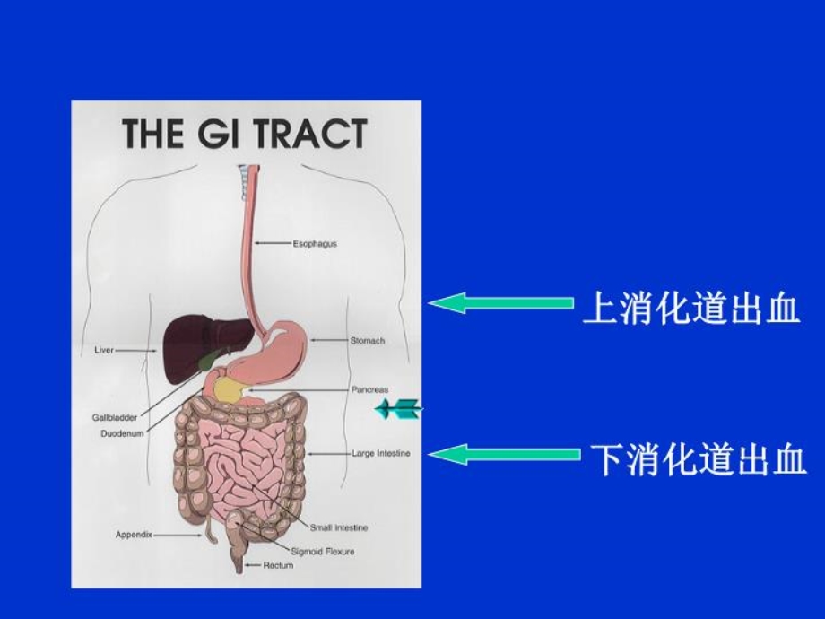 上消化道出血76755课件.ppt_第2页