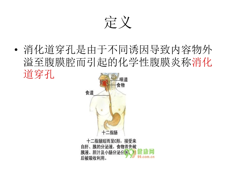 上消化道穿孔的护理PPT文档资料.ppt_第2页