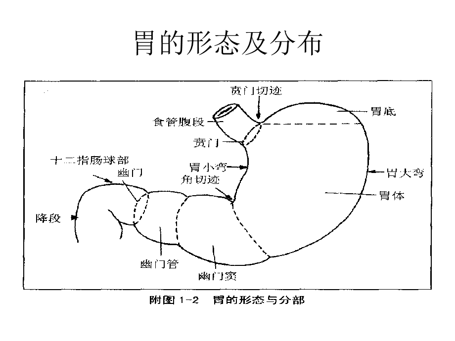 上消化道穿孔的护理PPT文档资料.ppt_第3页