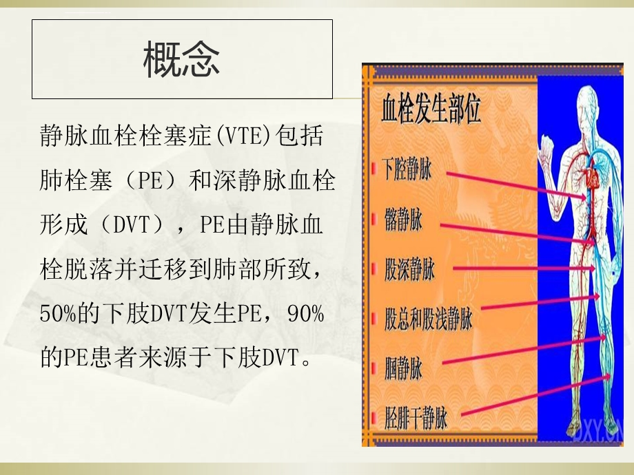 VTE的预防与治疗ppt课件.ppt_第2页