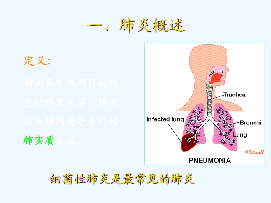 五肺炎球菌肺炎课件.ppt_第3页