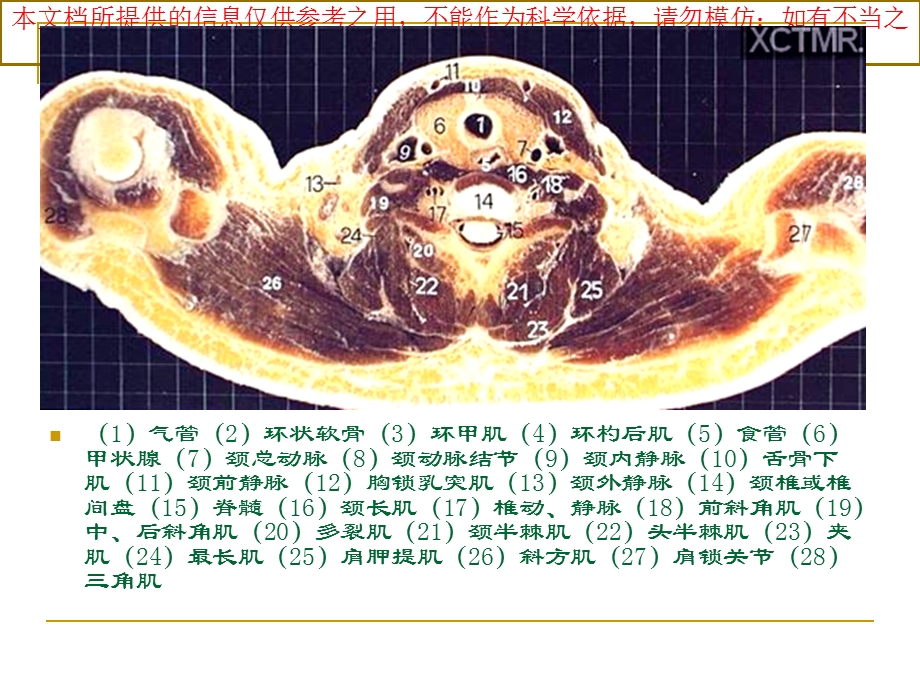 人体断层解剖图谱胸腔培训课件.ppt_第1页