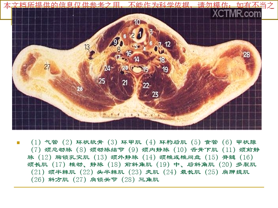 人体断层解剖图谱胸腔培训课件.ppt_第2页