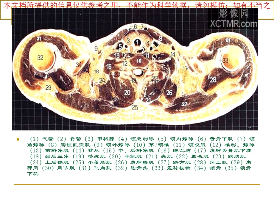 人体断层解剖图谱胸腔培训课件.ppt_第3页