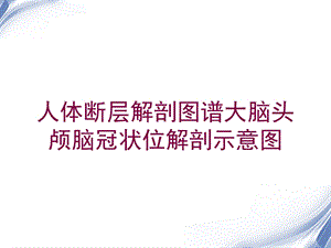 人体断层解剖图谱大脑头颅脑冠状位解剖示意图培训课件.ppt