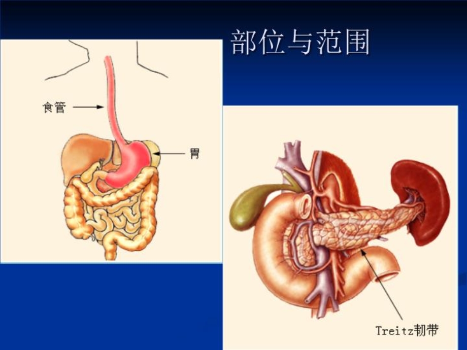 上消化道出血课件.ppt_第3页