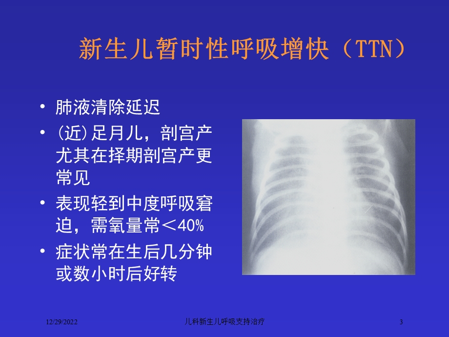 儿科新生儿呼吸支持治疗培训课件.ppt_第3页