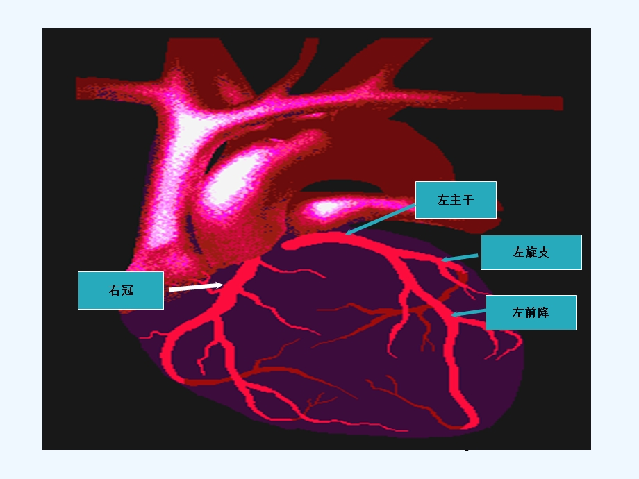 冠心病的中医养生课件.ppt_第3页