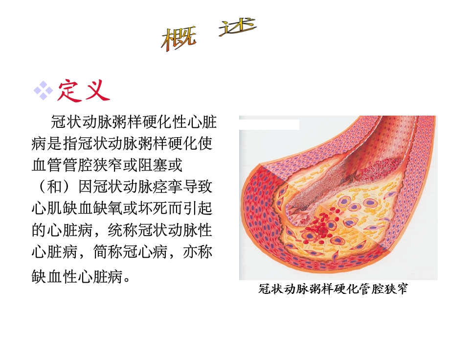 冠状动脉粥样硬化性心脏病人的护理课件.ppt_第3页