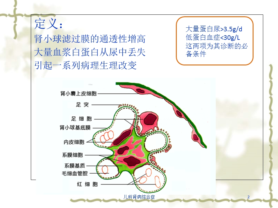 儿科肾病综合症培训课件.ppt_第2页