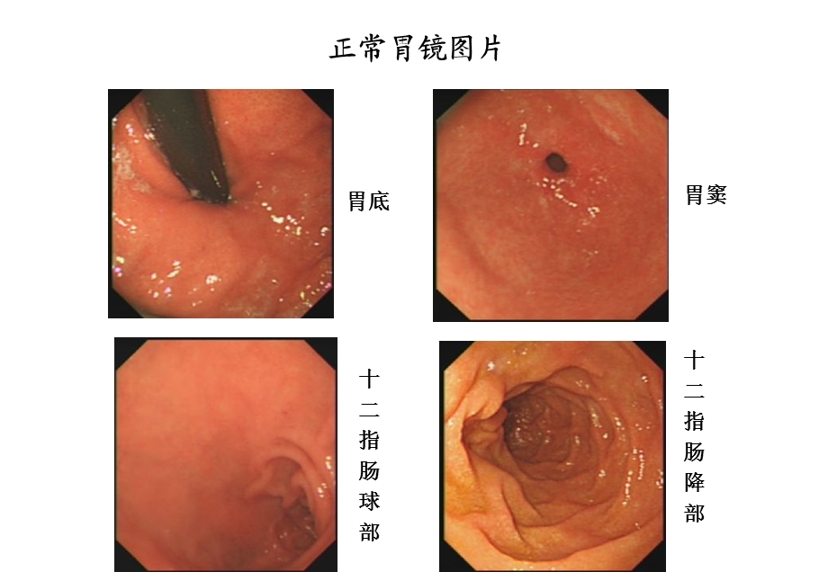 内科学(消化系统疾病)教学资源库课件.ppt_第3页