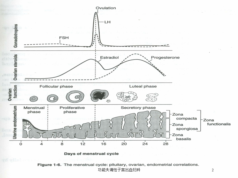 功能失调性子宫出血妇科培训课件.ppt_第2页