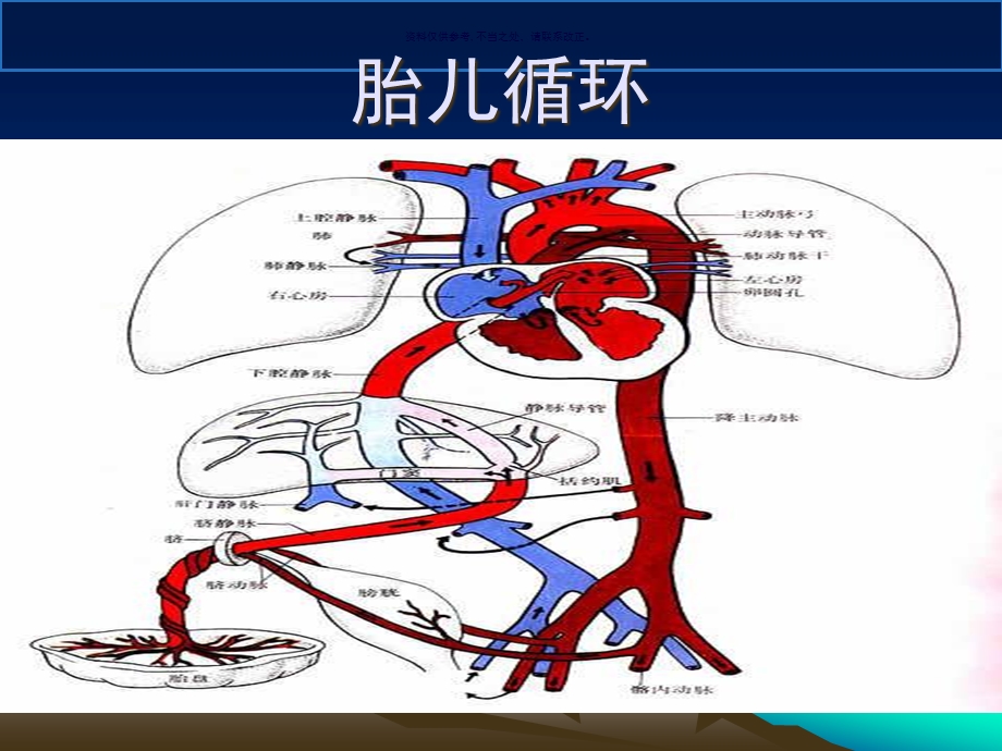 动脉导管未闭PDA课件.ppt_第3页